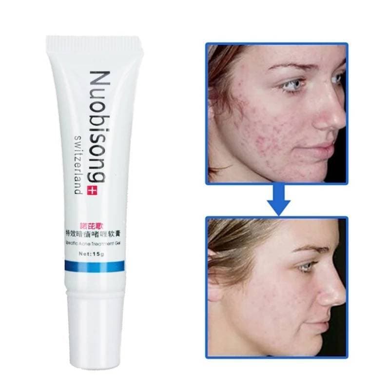 Nuobisong Stretch Mark Removal Cream Of Switzerland