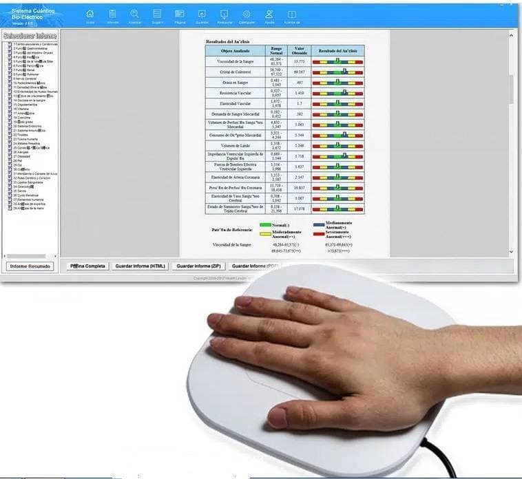 Quantum Body Analyzer Machine - WF-QA998