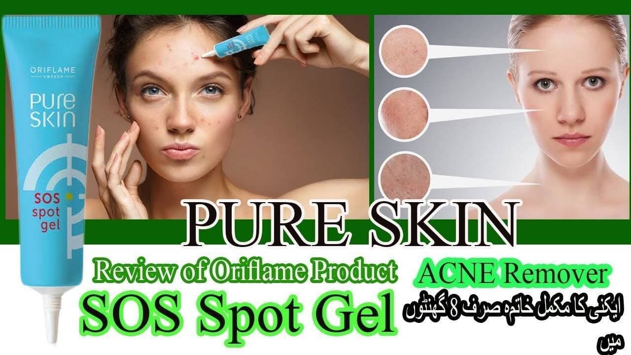 SOS spot Gel for acne(pimple)
