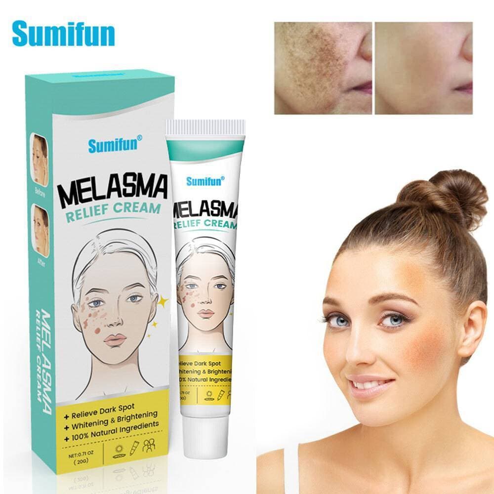 Dark Spot Removal Fade Blemish Melasma Treatment Skin Whitening Face Cream