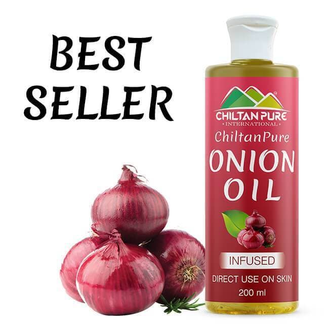 Chiltan Pure Red Onion Oil For Reduces Hair Fall